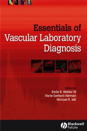 Essentials of Vascular Laboratory Diagnosis (1405103825) cover image