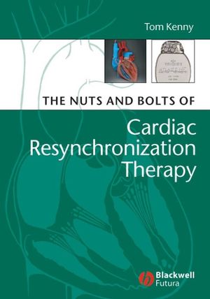 The Nuts and Bolts of Cardiac Resynchronization Therapy (1405153725) cover image