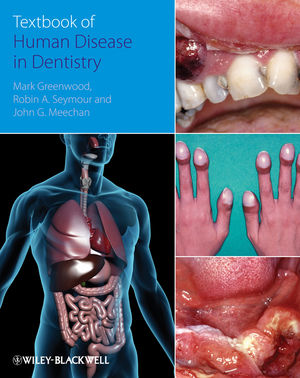 Textbook of Human Disease in Dentistry (1444316125) cover image