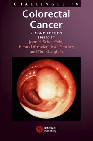 Challenges in Colorectal Cancer, 2nd Edition (0470753226) cover image