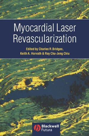 Myocardial Laser Revascularization (0470994827) cover image