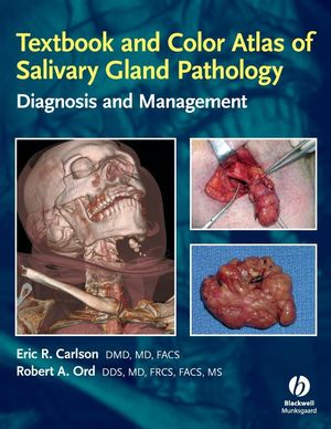 Textbook and Color Atlas of Salivary Gland Pathology: Diagnosis and Management  (0813802628) cover image