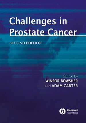 Challenges in Prostate Cancer, 2nd Edition (1405107529) cover image