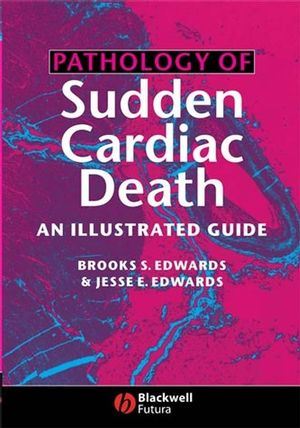 Pathology of Sudden Cardiac Death: An Illustrated Guide (1405122129) cover image