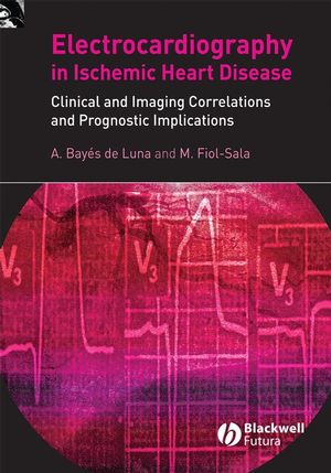 Electrocardiography in Ischemic Heart Disease: Clinical and Imaging Correlations and Prognostic Implications (1405173629) cover image