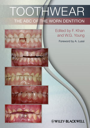 Toothwear: The ABC of the Worn Dentition (144434112X) cover image