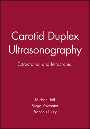 Carotid Duplex Ultrasonography: Extracranial and Intracranial (0879934832) cover image