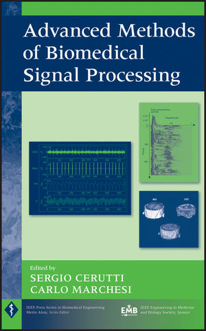 Advanced Methods of Biomedical Signal Processing (1118007735) cover image