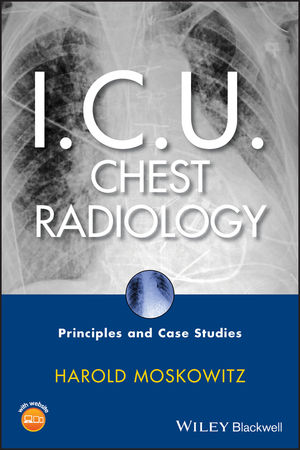 I.C.U. Chest Radiology: Principles and Case Studies (1118211235) cover image