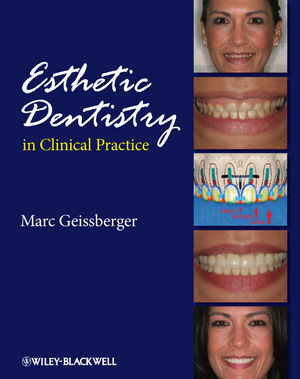 Esthetic Dentistry in Clinical Practice (1118694937) cover image