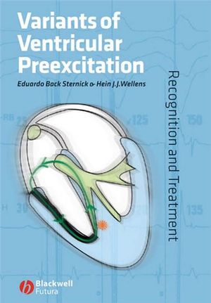 Variants of Ventricular Preexcitation: Recognition and Treatment (1405148438) cover image