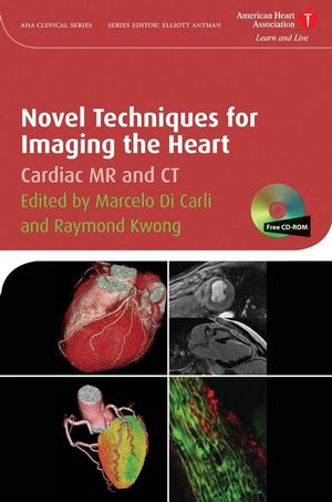 Novel Techniques for Imaging the Heart: Cardiac MR and CT (1405175338) cover image