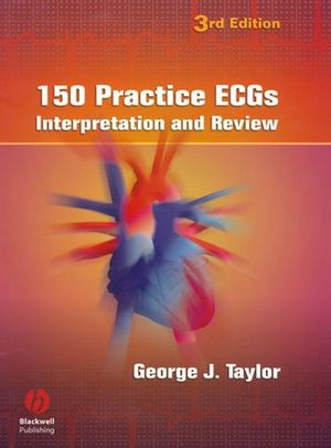 150 Practice ECGs: Interpretation and Review, 3rd Edition (140510483X) cover image