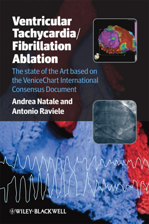 Ventricular Tachycardia / Fibrillation Ablation: The state of the Art based on the VeniceChart International Consensus Document (144433073X) cover image