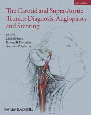 The Carotid and Supra-Aortic Trunks: Diagnosis, Angioplasty and Stenting, 2nd Edition (1405198540) cover image