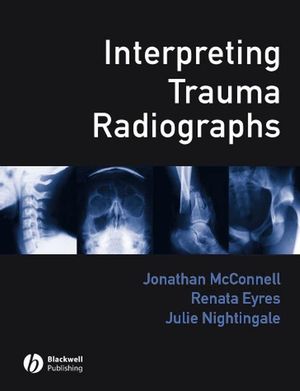 Interpreting Trauma Radiographs (1405115343) cover image