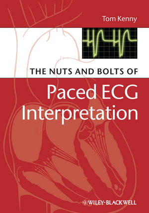 The Nuts and bolts of Paced ECG Interpretation (1405184043) cover image