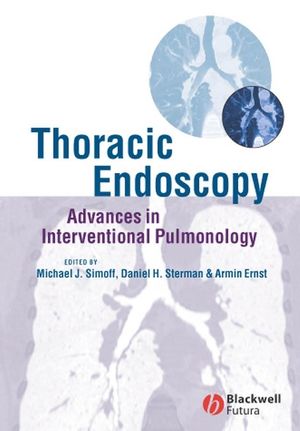 Thoracic Endoscopy: Advances in Interventional Pulmonology (1405122048) cover image