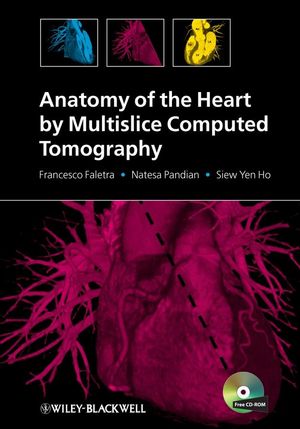 Anatomy of the Heart by Multislice Computed Tomography (1405180552) cover image