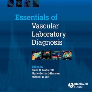 Essentials of Vascular Laboratory Diagnosis (1405122153) cover image