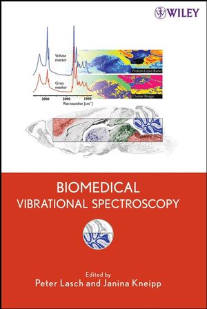 Biomedical Vibrational Spectroscopy  (0470229454) cover image