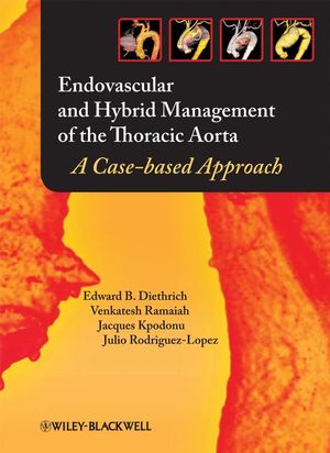 Endovascular and Hybrid Management of the Thoracic Aorta: A Case-based Approach (1405175354) cover image