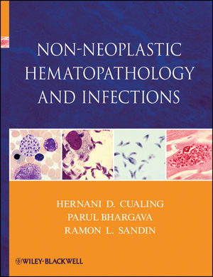 Non-Neoplastic Hematopathology and Infections (1118158555) cover image