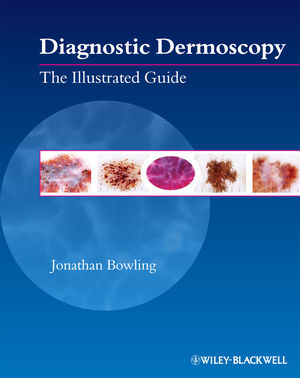 Diagnostic Dermoscopy: The Illustrated Guide (1444329855) cover image