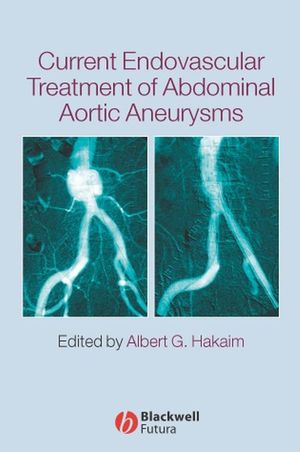 Current Endovascular Treatment of Abdominal Aortic Aneurysms (1405122056) cover image