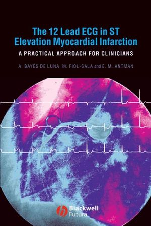 The 12 Lead ECG in ST Elevation Myocardial Infarction: A Practical Approach for Clinicians (1405157860) cover image