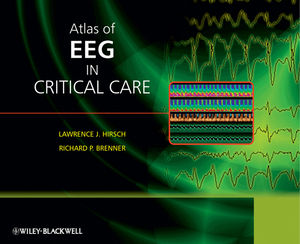 Atlas of EEG in Critical Care (0470987863) cover image