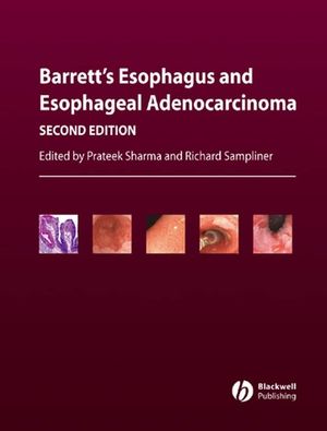 Barrett's Esophagus and Esophageal Adenocarcinoma, 2nd Edition (1405127864) cover image
