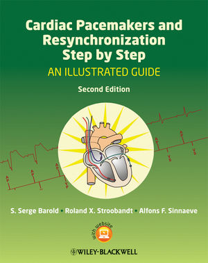 Cardiac Pacemakers and Resynchronization Step by Step: An Illustrated Guide, 2nd Edition (1405186364) cover image