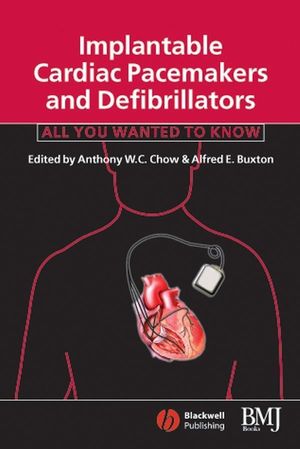 Implantable Cardiac Pacemakers and Defibrillators: All You Wanted to Know (0727915665) cover image