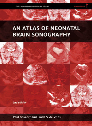 An Atlas of Neonatal Brain Sonography, 2nd Edition (1898683565) cover image