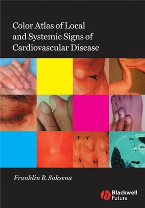 Color Atlas of Local and Systemic Manifestations of Cardiovascular Disease (1405159766) cover image