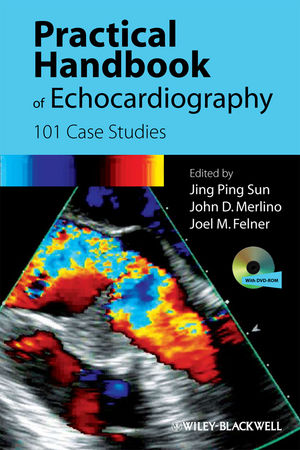 Practical Handbook of Echocardiography: 101 Case Studies (1405195568) cover image