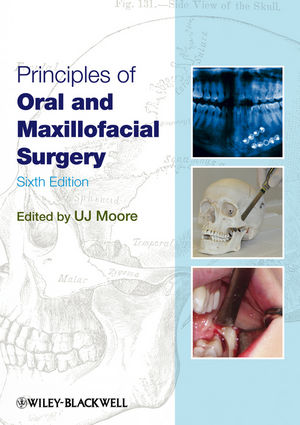 Principles of Oral and Maxillofacial Surgery, 6th Edition (1444393170) cover image