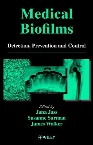Medical Biofilms: Detection, Prevention and Control (0471988677) cover image