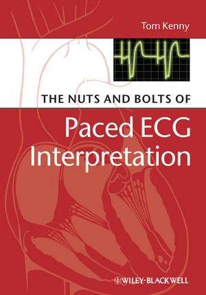 The Nuts and bolts of Paced ECG Interpretation (1444357077) cover image