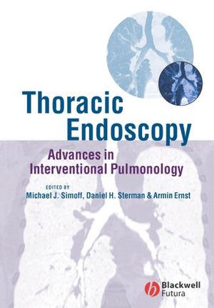 Thoracic Endoscopy: Advances in Interventional Pulmonology (047075527X) cover image