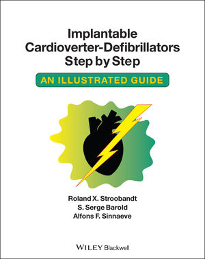 Implantable Cardioverter - Defibrillators Step by Step: An Illustrated Guide (1405186380) cover image