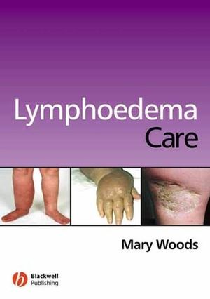 Lymphoedema Care (1405146281) cover image