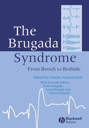The Brugada Syndrome: From Bench To Bedside (1405127783) cover image