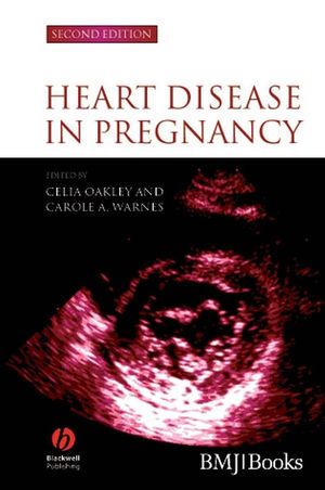Heart Disease in Pregnancy, 2nd Edition (1405134887) cover image
