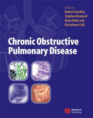 Chronic Obstructive Pulmonary Disease (0470755288) cover image