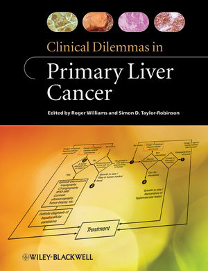 Clinical Dilemmas in Primary Liver Cancer (1119962188) cover image