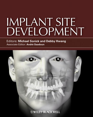 wiley implant site development michael sonick debby hwang wiley implant site development michael sonick debby hwang