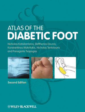 Wiley: Atlas Of The Diabetic Foot, 2nd Edition - Nicholas Katsilambros 