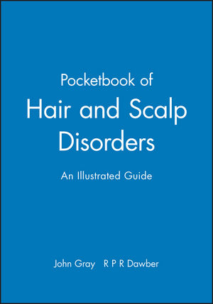A Pocketbook of Hair and Scalp Disorders: An Illustrated Guide (0632051892) cover image